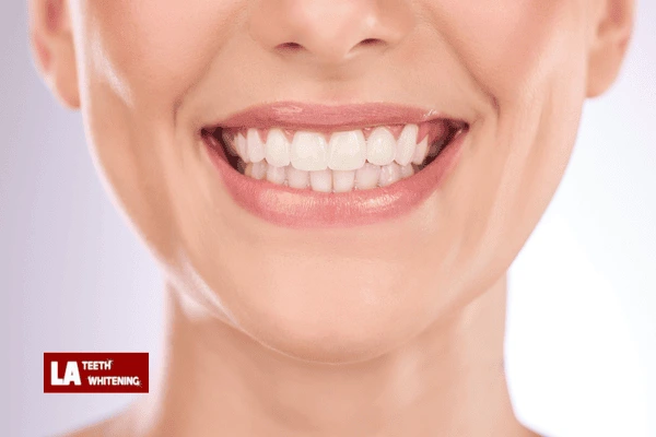 Can Laser Whitening Be Combined with Home Maintenance for Extra Brightness Bognor Regis