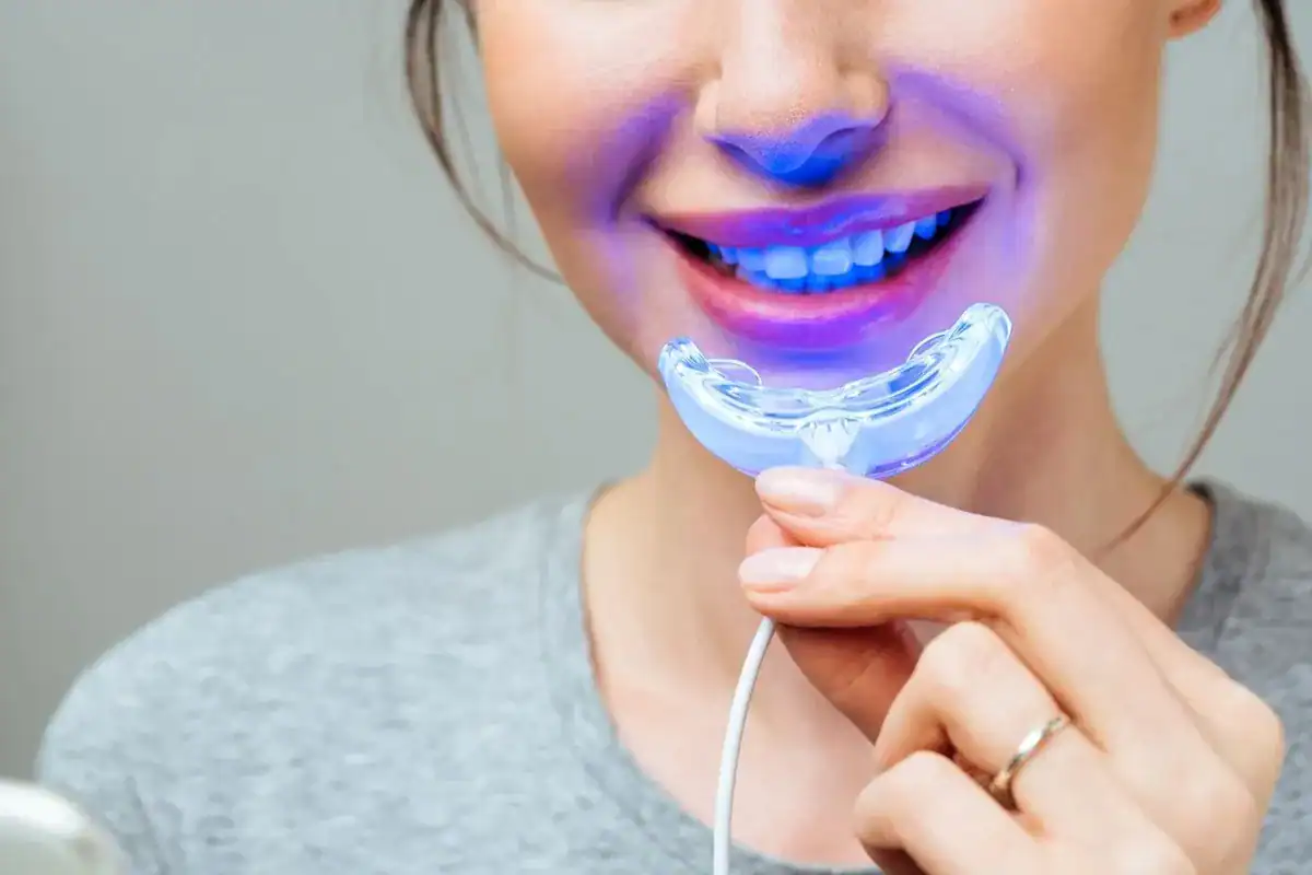Can Laser Whitening Correct Deep or Intrinsic Discolouration Bognor Regis