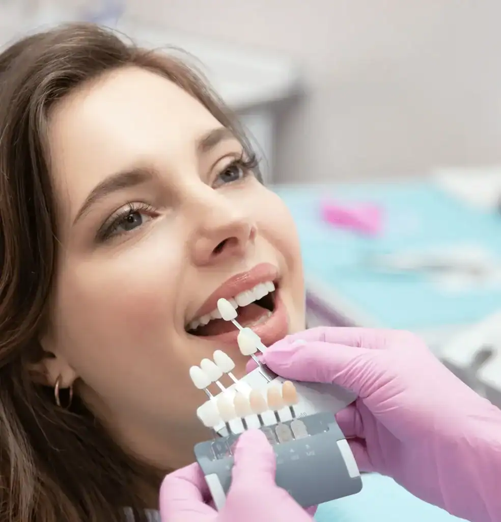 Can Laser Whitening Be Done on Teeth with Fillings or Crown Bognor Regis